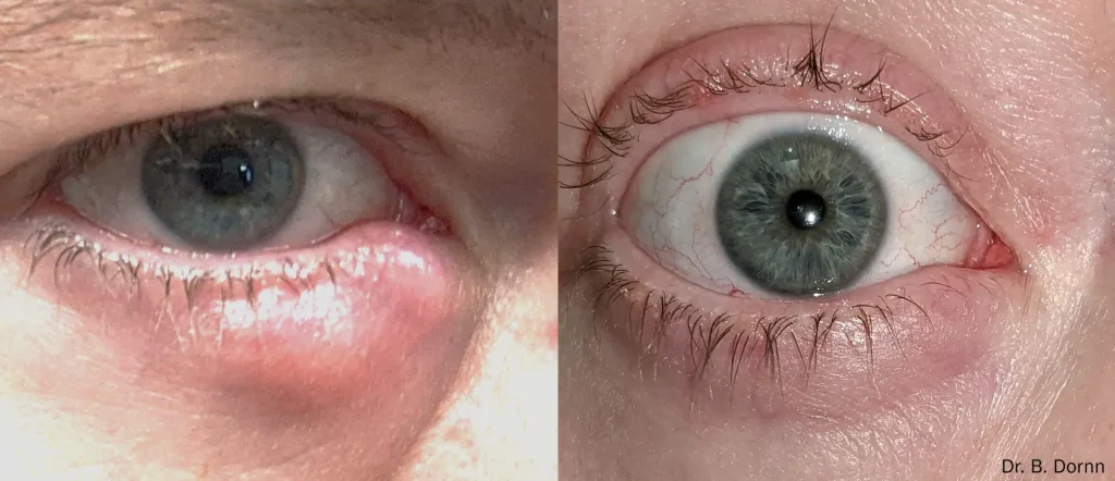 Before and After Eye Care Results image 1